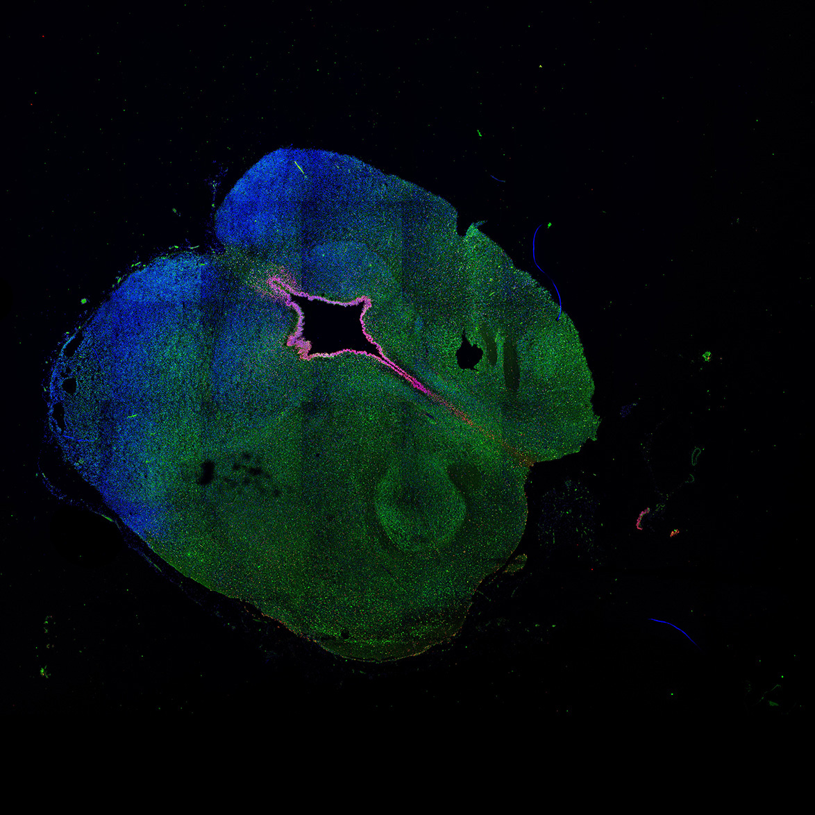 Human foetal midbrain